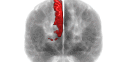 precuneus_l Laurent JAUDON | Transformation | Organisation apprenante